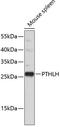 Parathyroid Hormone Like Hormone antibody, 18-983, ProSci, Western Blot image 