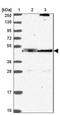Leucine Rich Repeat Containing 43 antibody, NBP2-14201, Novus Biologicals, Western Blot image 