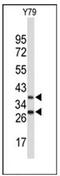 F-Box Protein 4 antibody, AP51631PU-N, Origene, Western Blot image 