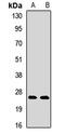 Cystatin-8 antibody, orb411954, Biorbyt, Western Blot image 