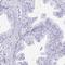 Lin-28 Homolog B antibody, HPA061745, Atlas Antibodies, Immunohistochemistry frozen image 