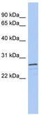 V-Set And Transmembrane Domain Containing 2A antibody, TA333397, Origene, Western Blot image 