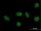 GA Binding Protein Transcription Factor Subunit Beta 1 antibody, H00002553-B01P, Novus Biologicals, Immunocytochemistry image 