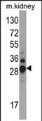 Dimethylarginine Dimethylaminohydrolase 1 antibody, PA5-35306, Invitrogen Antibodies, Western Blot image 