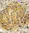 Plasminogen antibody, LS-C100898, Lifespan Biosciences, Immunohistochemistry paraffin image 