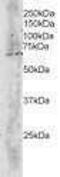 F-box-like/WD repeat-containing protein TBL1X antibody, PA1-31502, Invitrogen Antibodies, Western Blot image 
