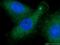 Cerebellar degeneration-related protein 2-like antibody, 14563-1-AP, Proteintech Group, Immunofluorescence image 