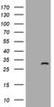 Zinc finger FYVE domain-containing protein 21 antibody, NBP2-46407, Novus Biologicals, Western Blot image 