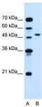 Nuclear Receptor Subfamily 1 Group I Member 2 antibody, TA345465, Origene, Western Blot image 