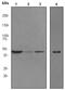 Angiotensin II Receptor Type 2 antibody, ab92445, Abcam, Western Blot image 