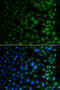 N(Alpha)-Acetyltransferase 40, NatD Catalytic Subunit antibody, abx007173, Abbexa, Western Blot image 