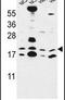 Canopy FGF Signaling Regulator 2 antibody, PA5-26952, Invitrogen Antibodies, Western Blot image 
