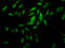 Epithelial Splicing Regulatory Protein 2 antibody, LS-C672109, Lifespan Biosciences, Immunofluorescence image 