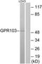 Pyroglutamylated RFamide peptide receptor antibody, TA315896, Origene, Western Blot image 