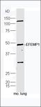 Deltex E3 Ubiquitin Ligase 3L antibody, orb183214, Biorbyt, Western Blot image 