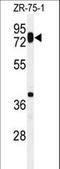 HAS1 antibody, LS-C166791, Lifespan Biosciences, Western Blot image 