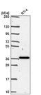 Secreted frizzled-related protein 1 antibody, HPA064870, Atlas Antibodies, Western Blot image 