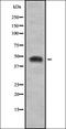 SS18 Subunit Of BAF Chromatin Remodeling Complex antibody, orb378422, Biorbyt, Western Blot image 