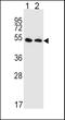 Solute Carrier Family 47 Member 1 antibody, LS-B10477, Lifespan Biosciences, Western Blot image 