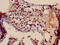 Transcription Factor Dp Family Member 3 antibody, LS-C674595, Lifespan Biosciences, Immunohistochemistry paraffin image 