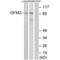 G Elongation Factor Mitochondrial 2 antibody, A11675, Boster Biological Technology, Western Blot image 
