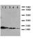 MDM2 Proto-Oncogene antibody, orb27590, Biorbyt, Western Blot image 