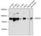 DEAD-Box Helicase 3 Y-Linked antibody, 14-107, ProSci, Western Blot image 