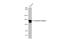 Xanthine Dehydrogenase antibody, GTX03231, GeneTex, Western Blot image 