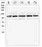 Transient Receptor Potential Cation Channel Subfamily C Member 5 antibody, A02701, Boster Biological Technology, Western Blot image 