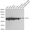 Eukaryotic Translation Elongation Factor 1 Gamma antibody, GTX32572, GeneTex, Western Blot image 