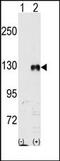 EPH Receptor B1 antibody, AP14295PU-N, Origene, Western Blot image 