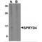 SPRY Domain Containing 4 antibody, MBS151300, MyBioSource, Western Blot image 