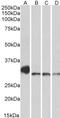 NIMA Related Kinase 7 antibody, LS-C139711, Lifespan Biosciences, Western Blot image 