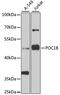 POC1 Centriolar Protein B antibody, MBS9128180, MyBioSource, Western Blot image 