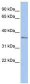 Homeobox protein SIX3 antibody, TA330271, Origene, Western Blot image 
