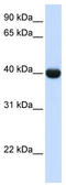 Alcohol Dehydrogenase 1A (Class I), Alpha Polypeptide antibody, TA346210, Origene, Western Blot image 