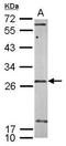 Small Nuclear Ribonucleoprotein U11/U12 Subunit 35 antibody, GTX119546, GeneTex, Western Blot image 