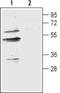 Aquaporin-9 antibody, PA5-77714, Invitrogen Antibodies, Western Blot image 