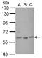 Zinc finger protein GLIS1 antibody, GTX117785, GeneTex, Western Blot image 