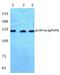 p130cas antibody, A00960Y249-1, Boster Biological Technology, Western Blot image 