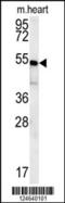 Hes Related Family BHLH Transcription Factor With YRPW Motif 2 antibody, 62-102, ProSci, Western Blot image 