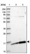 Chromosome 1 Open Reading Frame 189 antibody, NBP2-14556, Novus Biologicals, Western Blot image 