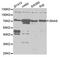 Guanine nucleotide-binding protein G(s) subunit alpha isoforms short antibody, A5546, ABclonal Technology, Western Blot image 