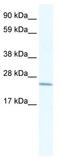 Cysteine Rich Protein 2 antibody, TA335871, Origene, Western Blot image 