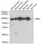 Bardet-Biedl Syndrome 2 antibody, GTX32466, GeneTex, Western Blot image 