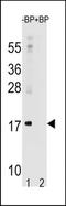 Microtubule Associated Protein 1 Light Chain 3 Alpha antibody, TA324624, Origene, Western Blot image 