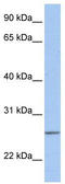 Ubiquitin-conjugating enzyme E2 C antibody, TA329811, Origene, Western Blot image 