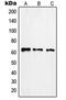 Rabaptin, RAB GTPase Binding Effector Protein 2 antibody, orb215294, Biorbyt, Western Blot image 