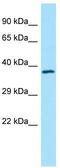 Tropomodulin 4 antibody, TA331237, Origene, Western Blot image 