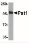 ST8 Alpha-N-Acetyl-Neuraminide Alpha-2,8-Sialyltransferase 4 antibody, NBP2-41063, Novus Biologicals, Western Blot image 